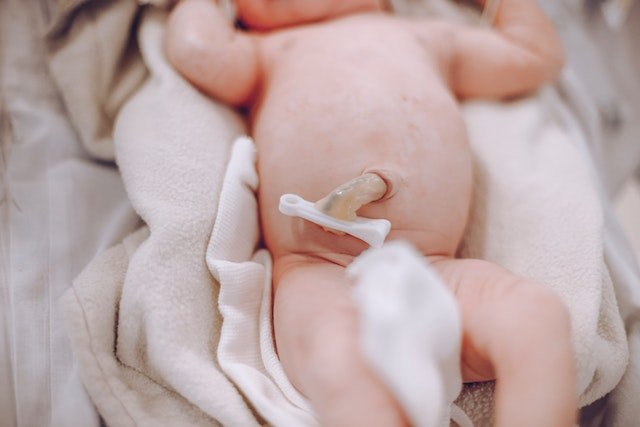 Newborn Umbilical Cord Care and Signs of Infection