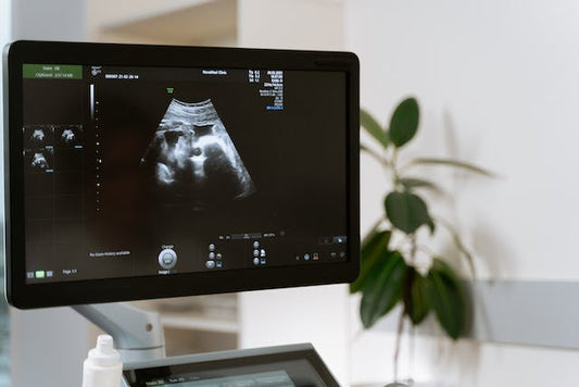Are Ultrasounds Safe for Babies? What Parents Need to Know - ANB BABY